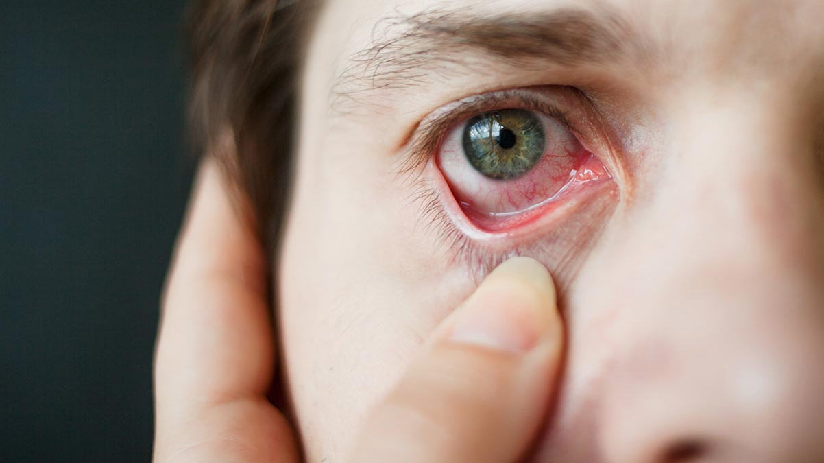 Occhi secchi? Potrebbero derivare da malattie autoimmuni dell'occhio