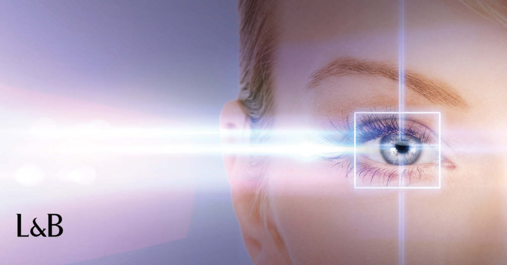 intervento laser miopia